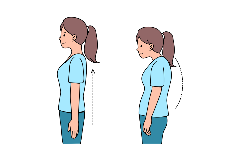 Hållningsrelaterat syndrom