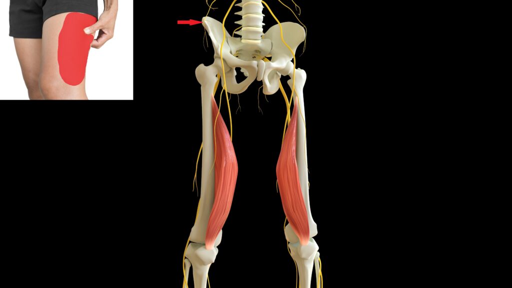 Meralgia paresthetica